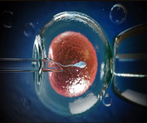 O que é FIV (Fertilização in Vitro) e como é realizada ?